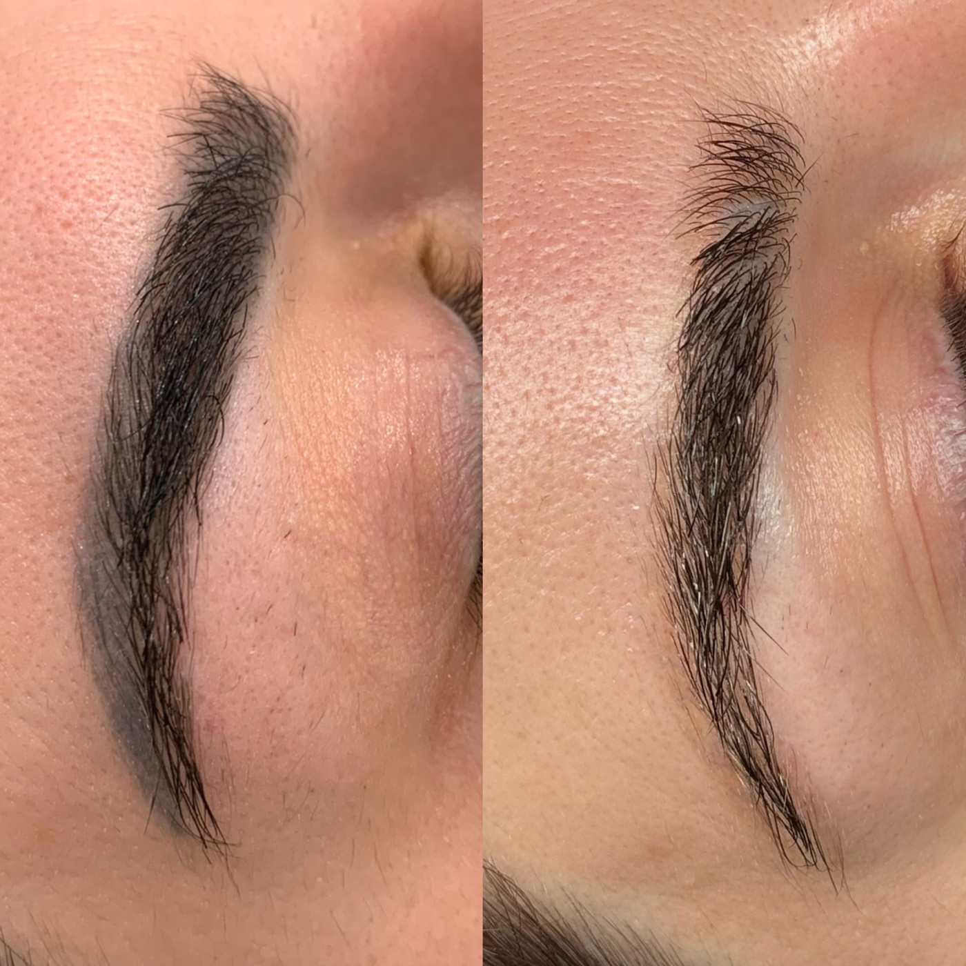 Brow tattoo before and after laser removal, from Gabrielle's previous studio